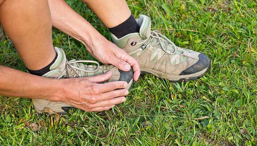 Los pacientes con micosis de los pies sienten dolor y dificultad para caminar. 